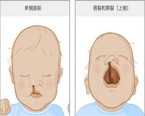 夫妻一方染色体异常能生出健康宝宝吗?三代试管PGS筛查详解