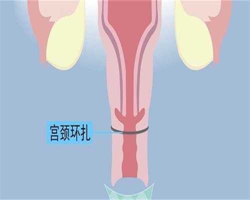 AA69助孕套餐价格明细,看看这笔钱花得值不值?性价比分析